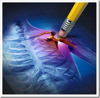 Scar Tissue Lake Havasu City AZ Chiropractic